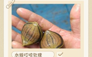 蚂蝗吸附后怎么快速安全去除？