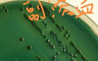 水产如何快速精准检测荧光弧菌？