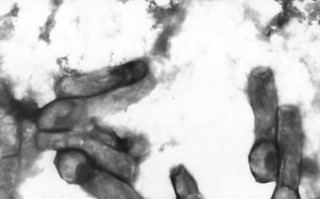 凝结芽孢杆菌如何助力水产养殖？