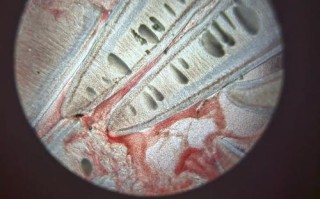 里鱼鳃孢子虫怎么治？有效方法有哪些？