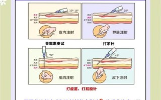 法氏囊病疫苗怎么用才正确？
