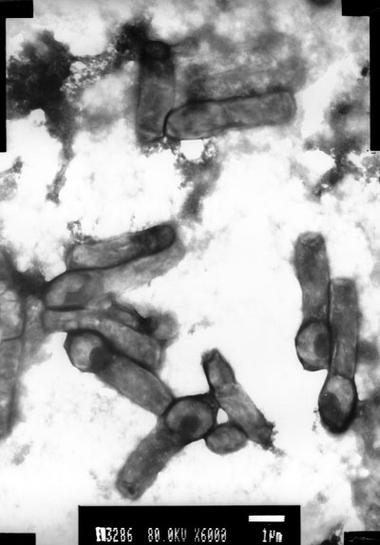 凝结芽孢杆菌如何助力水产养殖？-第1张图片-宁夏农业信息网