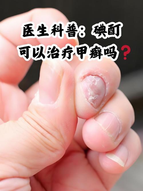 水产甲苯咪唑侵蚀皮肤-第2张图片-宁夏农业信息网