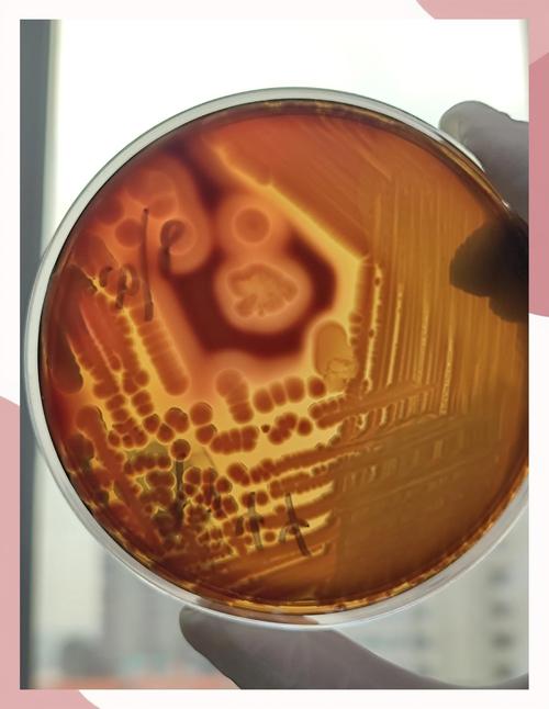 水产养殖弧菌测试标准有何新变化？-第2张图片-宁夏农业信息网