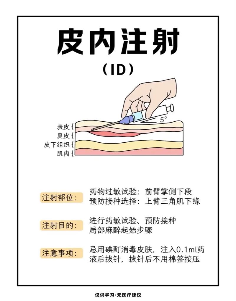 鸡禽流感疫苗怎么注射才正确?-第3张图片-宁夏农业信息网 鸡禽流感疫苗怎么注射才正确?-第3张图片-宁夏农业信息网