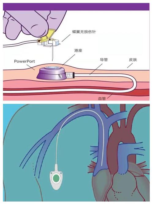 法氏囊病疫苗怎么用才正确？-第3张图片-宁夏农业信息网