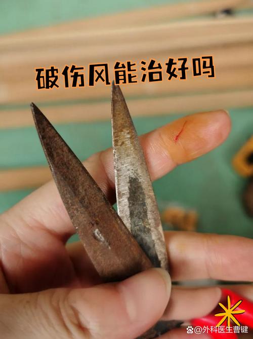 牛破伤风如何有效治疗？-第1张图片-宁夏农业信息网