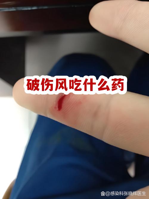 牛破伤风如何有效治疗？-第2张图片-宁夏农业信息网